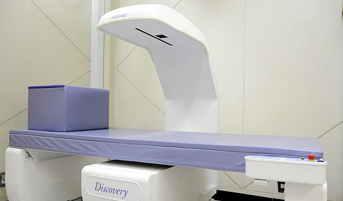 X線骨密度測定装置（DEXA法）